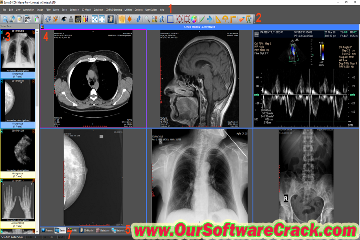 Sante DICOM Viewer Pro 12.2 PC Software with patch