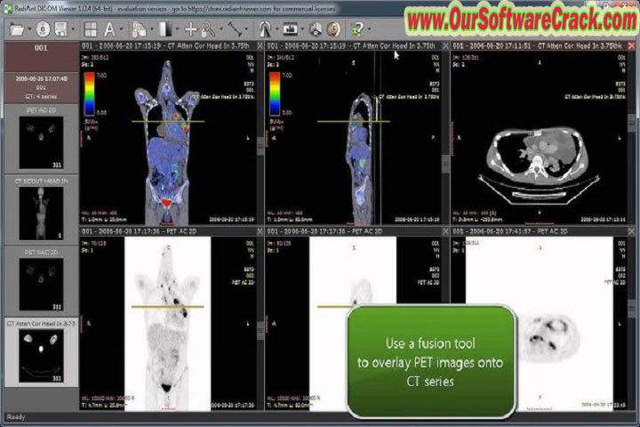Sante DICOM Viewer Pro 12.2 PC Software with crack