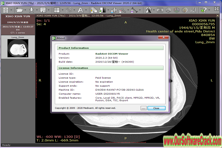 RadiAnt DICOM Viewer v2023.1 PC Software with keygen